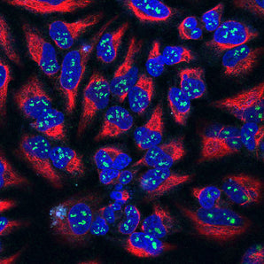 High magnification confocal image of HeLa cells stained with mouse mAb to fibrillarin, MCA-38F3, dilution 1:100 in green, and costained with chicken pAb to Vimentinm, <a href="http://encorbio.com/products/cpca-vim" target="_blank" rel="noopener">CPCA-Vim</a>, in red, 1:10,000. Nuclear DNA is revealed with the Hoechst stain in blue. The fibrillarin antibody shows strong staining of nucleoli in the nucleus, while the vimentin antibody reveals cytoplasmic intermediate filaments.