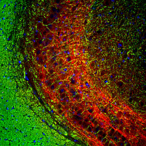 Immunofluorescent analysis of rat brain hippocampal section stained with mouse mAb to myelin basic protein (MBP), MCA-7D2, dilution 1:5,000 in green, and costained with rabbit pAb to NF-M, <a href="http://encorbio.com/products/rpca-nf-m" target="_blank" rel="noopener">RPCA-NF-M</a>, dilution 1:2,000, in red. The MBP antibody stains myelin sheathes around axons, while the NF-M antibody labels dendrites and axons of neuronal cells.