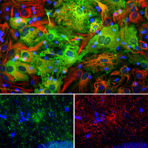 Immunofluorescent analysis of mixed cortical neuron-glial cell culture from an E20 rat stained with mouse mAb to aldehyde dehydrogenase family 1 member L1 (ALDH1L1), MCA-4A12, dilution 1:1,000 in green, and costained with chicken pAb to vimentin, <a href="https://encorbio.com/product/cpca-vim/" target="_blank" rel="noopener">CPCA-Vim</a>, dilution 1:5,000 in red. The blue is DAPI staining of nuclear DNA. MCA-4A12 antibody produces strong cytoplasmic staining of astrocytic glial cells, while the 