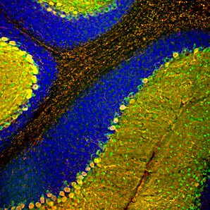 Immunofluorescent analysis of rat cerebellum section stained with mouse mAb to parvalbumin, MCA-3C9, dilution 1:1,000, in green, and costained with chicken pAb to calbindin, <a href="http://encorbio.com/products/cpca-calb"  target="_blank" rel="noopener">CPCA-Calb</a>, dilution 1:2,000 in red. The blue is DAPI staining of nuclear DNA. Following transcardial perfusion of rat with 4% paraformaldehyde, brain was post fixed for 24 hours, cut to 45μM, and free-floating sections were stained with abov