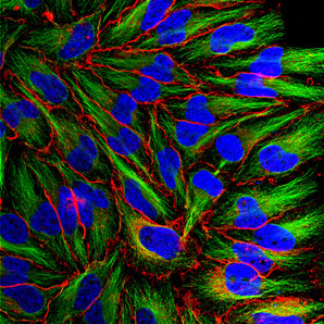 Immunofluorescent analysis of HeLa cells stained with rabbit pAb to MARCKS, RPCA-MARCKS, dilution 1:1,000 in red, and costained with mouse mAb to β-tubulin, <a href="http://encorbio.com/products/mca-1b12" target="_blank" rel="noopener">MCA-1B12</a>, dilution 1:10,000 in green. The blue is DAPI staining of nuclear DNA. The RPCA-MARCKS antibody recognizes protein localized in the plasma membrane and cytoplasm, while the β-tubulin antibody stains the network of cytoplasmic microtubules.