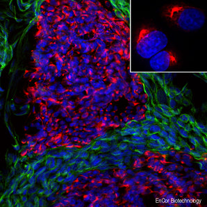 Immunofluorescent analysis of mixed fibroblast and rat pheochromocytoma PC12 cell culture stained with mouse mAb to peripherin, MCA-7C5, dilution 1:500 in red, and costained with chicken pAb to vimentin, <a href="http://encorbio.com/product/cpca-vim"  target="_blank" rel="noopener">CPCA-Vim</a>, dilution 1:10,000, in green. The blue is Hoechst staining of nuclear DNA. The MCA-7C5 antibody reveals cytoplasmic filamentous staining in the small PC12 cells, while vimentin antibody stains intermediat