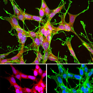 Immunofluorescent analysis of SH-SY5Y cells stained with rabbit pAb against DJ1/Park7, RPCA-DJ1, dilution 1:1,000 in red, and costained with EnCor mouse mAb to actin, <a href="https://encorbio.com/product/mca-5j11/" target="_blank" rel="noopener">MCA-5J11</a>, dilution 1:200 in green. The blue is Hoechst staining of nuclear DNA. The RPCA-DJ1 antibody reveals strong cytoplasmic staining for DJ1 protein, while the actin antibody labels the submembranous actin-rich cytoskeleton, stress fibers and b