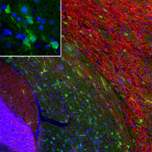 Immunofluorescent analysis of rat brain section stained with mouse mAb to PEA-15, MCA-4D117, dilution 1:1,000 in red, and costained with chicken pAb to MAP2, <a href="https://encorbio.com/product/rpca-gfap" target="_blank" rel="noopener">CPCA-MAP2</a>, dilution 1:5,000 in green. The blue is Hoechst staining of nuclear DNA. Following transcardial perfusion of rat with 4% paraformaldehyde, brain was post fixed for 24 hours, cut to 45μM, and free-floating sections were stained with above antibodies