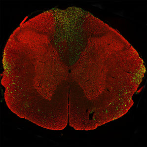 Immunostaining of a coronal section of the spinal cord of a rat given a midline C4 contusion injury three days previously. Sections were stained with <a href="http://encorbio.com/product/rpca-nf-l-ct" target="_blank" rel="noopener">RPCA-NF-L-ct</a> (red) and MCA-6H63 in green. MCA-6H63 stains prominent aggregates of material concentrated in the lateral funiculi and the dorsal columns but seen in lesser amounts throughout the section. These are degenerating and degenerated axons damaged by the C4