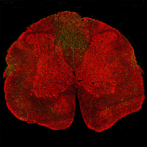 Immunostaining of a coronal section of the spinal cord of a rat given a midline C4 contusion injury three days previously. Sections were stained with <a href="http://encorbio.com/product/rpca-nf-l-ct" target="_blank" rel="noopener">RPCA-NF-L-ct</a> in red and MCA-1B11 in green. MCA-1B11 stains prominent aggregates of material concentrated in the lateral funiculi and the dorsal columns but seen in lesser amounts throughout the section. These are degenerating and degenerated axons damaged by the C