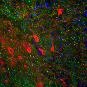 Immunofluorescent analysis of rat brain section stained with rabbit pAb to tyrosine hydroxylase, RPCA-TH, dilution 1:10,000, in red and costained with mouse mAb to pNF-H, <a href="http://encorbio.com/product/mca-ah1"  target="_blank" rel="noopener">MCA-AH1</a>, dilution 1:1,000 in green. The blue is Hoechst staining of nuclear DNA. Following transcardial perfusion of rat with 4% paraformaldehyde, brain was post fixed for 24 hours, cut to 45μM, and free-floating sections were stained with the abo