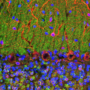 Confocal image of adult rat cerebellum stained with mouse mAb to vinsin-like protein 1 (VLP1), MCA-3A9, dilution 1:1,000, in green, and costained with chicken pAb to MAP2, <a href="http://encorbio.com/products/CPCA-MAP2">CPCA-MAP2</a>, dilution 1:10,000, in red. The blue is DAPI staining of nuclear DNA. The MCA-3A9 antibody reveals perikarya and synaptic regions in the neuron rich granular layer (bottom) and synapse rich molecular layer (top). Note that the large prominent Purkinje neurons at th