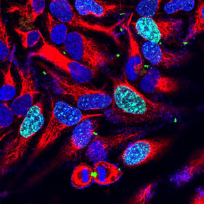 Immunofluorescent analysis of HeLa cells stained with mouse mAb to aurora B kinase, MCA-3F11, dilution 1:1,000 in green, and costained with chicken pAb to Vimentin, <a href="http://encorbio.com/products/cpca-vim"  target="_blank" rel="noopener">CPCA-Vim</a>, dilution 1:2,000 in red. The blue is DAPI staining of nuclear DNA. The MCA-3F11 reveals aurora B localized in midbodies, midzones of dividing cells and also in the nuclei or some cells.