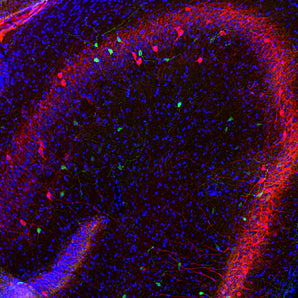 Immunofluorescent analysis of rat hippocampus section stained with chicken pAb to calretinin, CPCA-calret, dilution 1:1,000 in green, and costained with mouse mAb to parvalbumin, <a href="http://encorbio.com/products/mca-3c9/">MCA-3C9</a>, 1:1,000 in red. Following transcardial perfusion of rat with 4% paraformaldehyde, brain was post fixed for 24 hours, cut to 45μM, and free-floating sections were stained with the above antibodies. The calretinin and parvalbumin antibodies label different class