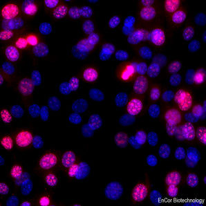 Immunofluorescent analysis of mouse NIH/3T3 cells stained with rabbit pAb to Ki-67 RPCA-Ki-67-Ro, dilution 1:1,000, red. The blue is Hoechst staining of nuclear DNA. The RPCA-Ki-67-Ro antibody stains Ki-67 protein predominantly expressed in nucleoli of cells in interphase, while cells in the quiescent G0 state do not express Ki-67 protein. Dividing cells express Ki67 surrounding condensed chromosomes.