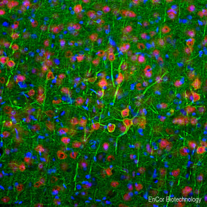 Immunofluorescent analysis of a rat frontal cortex section stained with mouse mouse mAb to NF-L, MCA-6H112, dilution 1:2,000 in green, and costained with rabbit pAb to FOX3/NeuN, <a href="http://encorbio.com/product/rpca-fox3"  target="_blank" rel="noopener">RPCA-FOX3</a>, dilution 1:2,000 in red. Following transcardial perfusion of rat with 4% paraformaldehyde, brain was post fixed for 24 hours, cut to 45μM, and free-floating sections were stained with the above antibodies. The MCA-6H112 antibo