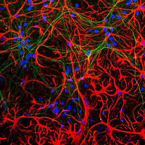 Immunofluorescent analysis of cortical neuron-glial cell culture from E20 rat stained with mouse mAb to GFAP, MCA-5C10, dilution 1:1,000 in red, and costained with rabbit pAb to NF-L, <a href="http://encorbio.com/product/cpca-nf-l"  target="_blank" rel="noopener">CPCA-NF-L</a>, dilution 1:2,000 in red. The blue is DAPI staining of nuclear DNA. The MCA-5C10 antibody stains astrocytes, while CPCA-NFL antibody reveals dendrites and axons of neurons.