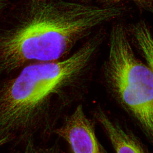 Immunofluorescent analysis of HeLa cell culture stained with rabbit pAb to catalase, RPCA-Catalase, dilution 1:2,000 in red, and costained with mouse mab to &beta;-tubulin, <a href="https:encorbio.com/product/MCA-4E4" target="_blank" rel="noopener">MCA-4E4</a>, dilution 1:5,000 in green. The blue is Hoechst staining of nuclear DNA. The RPCA-Catalase antibody reveals vesicular staining of peroxisomes in the cytoplasm, and MCA-4E4 antibody produces strong staining of cytoplasmic microtubules.