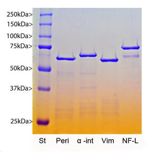 Coomassie Brilliant Blue stained SDS-PAGE gel of various recombinant proteins expressed in and purified from <em>E. coli</em>. 1µg of protein was run on each lane, and the lane indicated with “NF-L” contains the human neurofilament NF-L protein. The other lanes show recombinant human peripherin (Peri), human α-internexin (α-int) and human vimentin (Vim) as indicated. Protein molecular weight standards are in the first lane and apparent molecular weights of the recombinant proteins are as indicat