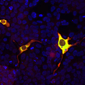 HEK293 cells were transfected with a construct including the C-terminal 250 amino acids of <em>S. aureus</em> CAS9 fused to GFP and stained with RPCA-CAS9-Sa in red. Transfected cells express the green fusion protein and bind the antibody in red, producing a yellow signal. Nuclear DNA in transfected and non-transfected cells is revealed with the blue DNA stain DAPI.