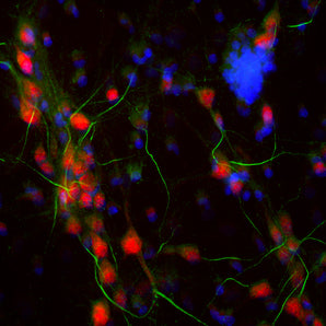 Immunofluorescent analysis of cortical neuron-glial cell culture from E20 rat stained with chicken pAb to ankyrin 3, CPCA-ANK3, dilution 1:2,000 in green, and costained with mouse mAb to FOX3/NeuN, <a href="http://encorbio.com/product/mca-1b7" target="_blank" rel="noopener">MCA-1B7</a>, dilution 1:2,000 in red. The blue is Hoechst staining of nuclear DNA. The CPCA-ANK3 antibody stains the axonal initial segments, while the FOX3/NeuN antibody reveals perikarya and nuclei of neurons.