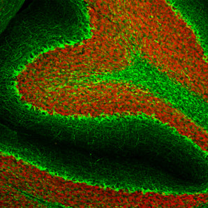 Immunohistological analysis of rat cerebellum section stained with mouse mAb to pNF-H, MCA-AH1, dilution 1:2,000 in green, and costained with rabbit pAb to FOX3/NeuN, <a href="http://encorbio.com/products/rpca-fox3/">RPCA-FOX3</a>, dilution 1:5,000 in red. Following transcardial perfusion with 4% paraformaldehyde, brain was post fixed for 24 hours, cut to 45μM, and free-floating sections were stained with above antibodies. The MCA-AH1 antibody stains axons in the granular layer and white matter 