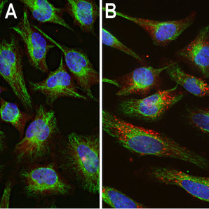 Immunofluorescent analysis of HeLa cells stained with rabbit pAb to ubiquitin, RPCA-Ubi, dilution 1:1,000 in red, and costained with chicken pAb to vimentin, <a href="http://encorbio.com/products/cpca-vim"  target="_blank" rel="noopener">CPCA-Vim</a>, dilution 1:10,000, in green. The blue is DAPI staining of nuclear DNA. [A] Control HeLa cells maintained in normal medium, [B] HeLa cells treated with 10µM of the proteasome inhibitor lactacystin (Lc) for 24 hours. Proteasomal inhibition leads to f