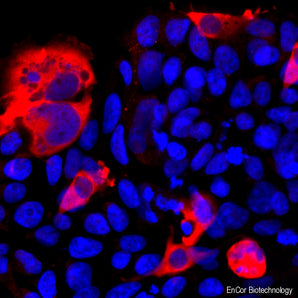 Immunofluorescent analysis of HEK293 cells transfected with pCI-Neo-Mod vector including DNA encoding full length Cas&Phi; protein and stained with rabbit pAb against Cas&Phi;, RPCA-Cas12J, in red. The blue is Hoechst staining of nuclear DNA. The antibody reveals cytoplasmic expression of the Cas&Phi; protein only in transfected cells.