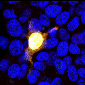 HEK293 cells were transfected with a construct including the N-terminal 608 amino acids of <em>S. pyogenes</em> CAS9 fused to GFP and stained with mouse mAb to N-terminal region of <em>S. pyogenes</em> Cas9, MCA-3F9, in red. Transfected cells express the green fluorescent fusion protein and bind the antibody in red, producing a yellow signal. Nuclear DNA in transfected and non-transfected cells is revealed with the blue DNA stain Hoechst.