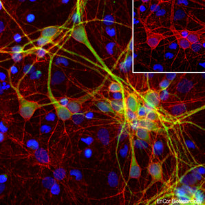 Immunofluorescent analysis of cortical neuron-glial cell culture from E20 rat embryos stained with mouse mAb to αII-Spectrin, MCA-3D7, dilution 1:500 in red, and costained with chicken pAb to Microtubule Associated Protein2 (MAP2), <a href="http://encorbio.com/products/cpca-map2" target="_blank" rel="noopener">CPCA-MAP2</a>, dilution 1:10,000 in green. The blue is Hoechst staining of nuclear DNA. The spectrin antibody stains membranes of neuronal cell body, axons and their dendrites, while MAP2 