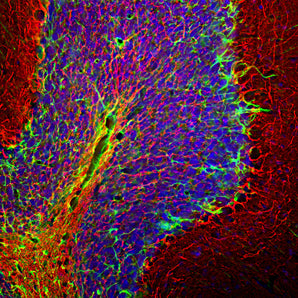 Immunohistological analysis of a rat cerebellum section stained with chicken pAb to NF-H, CPCA-NF-H, dilution 1:5,000 in red, and costained with rabbit pAb to GFAP, <a href="http://encorbio.com/products/rpca-gfap" target="_blank" rel="noopener">RPCA-GFAP</a>, dilution 1:5,000 in green. The blue is DAPI staining of nuclear DNA. Following transcardial perfusion with 4% paraformaldehyde, brain was post fixed for 24 hours, cut to 45μM, and free floating sections were stained with above antibodies. T