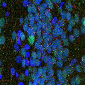 Immunofluorescence analysis of rat hippocampus section stained with rabbit pAb to to adenylate cyclase III, RPCA-ACIII, in red and costained with mouse mAb to MECP2, <a href="http://encorbio.com/products/mca-5h12/" target="_blank" rel="noopener">MCA-5H12</a>, in green. The blue is DAPI staining of nuclear DNA. The ACIII antibody reveals neuronal cilia while the MECP2 antibody reveals the nuclei of certain neurons to a variable degree. This is a stacked confocal image made with a 100X objective l