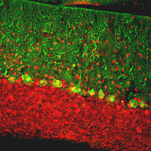 Immunofluorescent analysis of rat cerebellum section stained with chicken pAb to calbindin, CPCA-Calb, dilution 1:2,000, in green, and costained with rabbit pAb to MeCP2, <a href="http://encorbio.com/products/rpca-MeCP2" target="_blank" rel="noopener">RPCA-MeCP2</a>, dilution 1:5,000, in red. Following transcardial perfusion with 4% paraformaldehyde, brain was post fixed for 24 hours, cut to 45μM, and free-floating sections were stained with above antibodies. Calbindin, often used as a Purkinje 