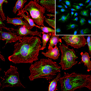 Immunofluorescent analysis of HeLa cell culture stained with goat pAb to vimentin, GPCA-Vim, dilution 1:500 in green, and costained with mouse mAb to actin, <a href="http://encorbio.com/products/mca-5j11" target="_blank" rel="noopener">MCA-5J11</a>, dilution 1:500 in red. Blue is Hoechst staining of nuclear DNA. GPCA-Vim antibody produces strong staining of intermediate filament network of the cytoskeleton, while actin antibody stains the submembranous actin-rich cytoskeleton, stress fibers and 