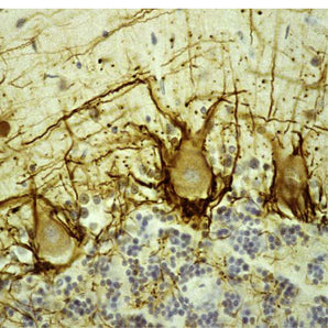 Immunohistological analysis of human cerebellar cortex section stained with mouse mAb to pNF-H, MCA-NAP4, in brown. Paraffin-embedded, formalin-fixed tissue sections were stained with this antibody using the avidin biotin conjugate method. The sections was counterstained with Hematoxylin in blue. MCA-NAP4 stains prominent basket cell axons surrounding the large Purkinje neurons. Cerebellar granule cell layer is at the bottom of the image, the molecular layer at the top.