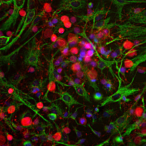 Immunofluorescent analysis of cortical neuron-glial cell culture from E20 rat stained with chicken  pAb to UCHL1, CPCA-UCHL1 <strong>,</strong> dilution 1:500 in red, and costained with mouse mAb to vimentin,  <a href="http://encorbio.com/products/mca-2a52/">MCA-2A52</a>, dilution 1:2,000, in green. The blue is Hoechst staining of nuclear DNA. The UCHL1 antibody produces strong staining of the cell body and dendrites in neurons. The vimentin antibody stains intermediate filaments in fibroblastic