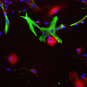 View of mixed neuron/glial cultures stained with MCA-E9 (red) and our chicken antibody to GFAP antibody (<a href="http://encorbio.com/products/cpca-gfap" target="_blank" rel="noopener">CPCA-GFAP</a>, green). The MCA-E9 antibody reveals strong cytoplasmic staining in a subset of non-neuronal cells and apparently all astrocyte cell body and processes, whereas GFAP labels the intermediate filament of the cytoskeleton in a subset of astrocytes.