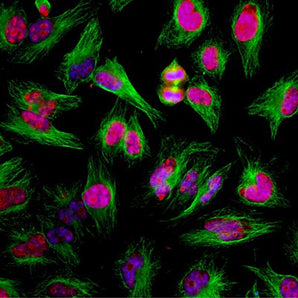 Immunofluorescent analysis of HeLa cells stained with chicken pAb to Ki67, CPCA-Ki67, dilution 1:2,000 in red, and mouse mAb to β-tubulin  <a href="http://encorbio.com/products/mca-1b12/" target="_blank" rel="noopener">MCA-1B12</a>, dilution 1:5,000 in green. The blue is DAPI staining of nuclear DNA. The CPCA-Ki67 antibody detects Ki67 protein predominantly expressed in nucleoli of cells in interphase and in mitotic cells Ki67 forms a coat around condensed chromosomes. Ki67 is not detected in ce