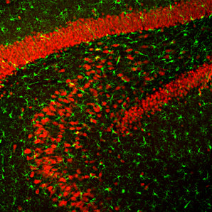 Immunofluorescent analysis of rat hippocampus section stained with chicken pAb to FOX3/NeuN, CPCA-FOX3, dilution 1:5,000 in red, and costained with rabbit pAb to IBA1, <a href="http://encorbio.com/products/rpca-iba1" target="_blank" rel="noopener">RPCA-Iba1</a>, dilution 1:2,000, in green. Following transcardial perfusion with 4% paraformaldehyde, rat brain was post fixed for 24 hours, cut to 35μM, and free-floating sections were stained with the above antibodies. The FOX3/NeuN antibody stains t