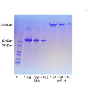 Purified Pig Neurofilament NF-H (Nfh, NEFH) Prot-m-NF-H-por