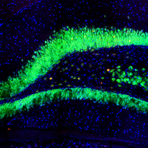 Immunofluorescent analysis of rat hippocampus section stained with mouse mAb to c-FOS, MCA-2H2, dilution 1:200, in red, and costained with rabbit pAb to FOX3/NeuN, <a href="http://encorbio.com/products/rpca-fox3" target="_blank" rel="noopener">RPCA-FOX3</a>, dilution 1:3,000, in green. The blue is Hoechst staining of nuclear DNA. The MCA-2H2 antibody labels nuclei of spontaneously activated neurons, while FOX3/NeuN antibody stains nuclei and distal perikarya of most neurons.