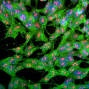 Immunofluorescent analysis of SH-SY5Y cells stained with rabbit pAb to UCHL1, RPCA-UCHL1, dilution 1:1,000 in green, and costained with mouse mAb to fibrillarin, <a href="http://encorbio.com/products/mca-38f3-3/" target="_blank" rel="noopener">MCA-38F3</a>, dilution 1:1,000 in red. The blue is Hoechst staining of nuclear DNA. The UCHL1 antibody produces strong staining of the cellular cytoplasm of these cells which share many properties with neurons, while the MCA-38F3  antibody specifically lab