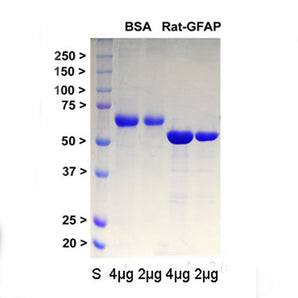 &nbsp;&nbsp;&nbsp;&nbsp;&nbsp;&nbsp; A codon optimized cDNA encoding isotype I of rat GFAP was generated and inserted into the pET29a(+) expression vector which adds a C-terminal His-tag to the rat sequence. The construct was expressed by standard methods in <em>E. coli</em> and purified using a Nickel column in 6M urea. The protein is supplied in this form as it would aggregate in more physiological buffers. The lane on the far left contains protein standards of the indicated molecular size in 