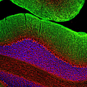 Immunofluorescent analysis of rat cerebellum section stained with rabbit pAb to NF-M, RPCA-NF-M, dilution 1:2,000 in red, and costained with mouse mAb to GAP43, <a href="http://encorbio.com/products/mca-3h14"  target="_blank" rel="noopener">MCA-3H14</a>, dilution 1:2,000 in green. Following transcardial perfusion of rat with 4% paraformaldehyde, brain was post fixed for 24 hours, cut to 45μM, and free-floating sections were stained with the above antibodies. The RPCA-NF-M antibody strongly label