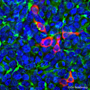 Immunofluorescent analysis of HEK293 cells transfected with pCI-Neo-Mod vector (5) including DNA encoding the CasΦ protein, stained with mouse mAb against CasΦ, MCA-5F95, dilution 1:2,000, in red, and costained with rabbit pAb to vimentin, <a href="http://encorbio.com/product/rpca-vim" target="_blank" rel="noopener">RPCA-Vim</a>, dilution 1:2,000, in green. The blue is Hoechst staining of nuclear DNA. The MCA-5F95 antibody reveals expression of the CasΦ protein only in transfected cells. The vim