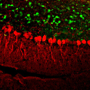 Immunofluorescent analysis of rat cerebellum section stained with mouse mAb to calretinin, MCA-3G9, dilution 1:500 in green, and costained with chicken pAb to calbindin, <a href="http://encorbio.com/products/cpca-calb/">CPCA-Calb</a>, dilution 1:2,000 in red. Following transcardial perfusion of rat with 4% paraformaldehyde, brain was post fixed for 24 hours, cut to 45μM, and free-floating sections were stained with the above antibodies. The calretinin antibody labels interneurons in the granule 