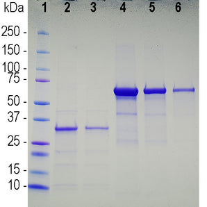 SDS-PAGE gel of recombinant human SARS-CoV-2 cell binding region. Lane 1 shows protein standards of apparent molecular weight as indicated in kiloDaltons. Lanes 2 and 3 are two loadings of the recombinant SARS-CoV-2 binding domain construct, running at about 32kDa as expected. Lanes 4 to 6 are 5.6&mu;g,2.83&mu;g and 1.4&mu;g of BSA.