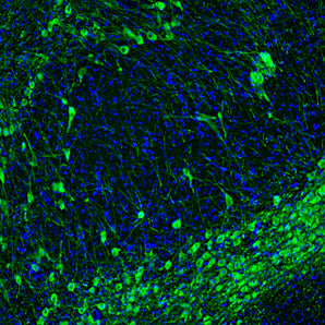 Immunofluorescent analysis of rat brain section stained with chicken pAb to tyrosine hydroxylase, CPCA-TH, dilution 1:5,000, in green. The blue is Hoechst staining of nuclear DNA. CPCA-TH antibody stains the dopaminergic TH-positive neurons and their processes of the substantia nigra.