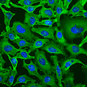 Immunofluorescent analysis of HeLa cells stained with mouse mAb to GAPDH, MCA-1D4, dilution 1:100 in green. Blue is Hoechst staining of nuclear DNA. The MCA-1D4 antibody produces strong cytoplasmic staining of healthy cells.