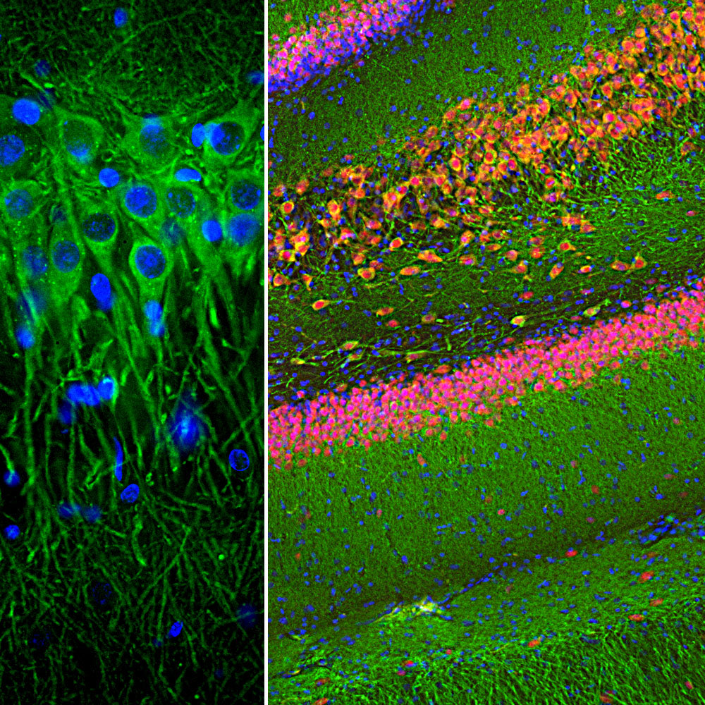 Map2 Mouse Mouse Monoclonal Antibody to Microtubule Associated Protein MAP2AB (MA ...