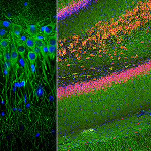 Immunofluorescent analysis of a rat hippocampus section stained with mouse mAb to MAP2, MCA-4H5, dilution 1:2,000 in green, and costained with rabbit pAb to FOX3/NeuN, <a href="https://encorbio.com/product/rpca-fox3/"  target="_blank" rel="noopener">RPCA-FOX3</a>, dilution 1:2,000 in red. Following transcardial perfusion of rat with 4% paraformaldehyde, brain was post fixed for 24 hours, cut to 45μM, and free-floating sections were stained with above antibodies. The MCA-4H5 antibody labels MAP2 