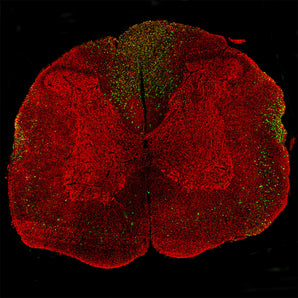 Immunostaining of a coronal section of the spinal cord of a rat given a midline C4 contusion injury three days previously. Sections were stained with <a href="http://encorbio.com/product/rpca-nf-l-ct" target="_blank" rel="noopener">RPCA-NF-L-ct</a> (red) and CPCA-NF-L-Degen in green. CPCA-NF-L-Degen stains prominent aggregates of material concentrated in the lateral funiculi and the dorsal columns but seen in lesser amounts throughout the section. These are degenerating and degenerated axons dam