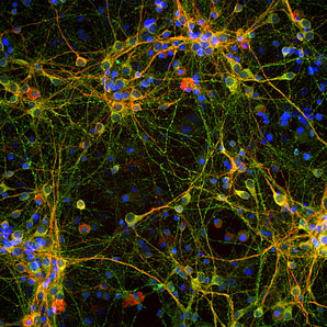 Immunofluorescent analysis of cortical neuron-glial culture from E20 rat stained with chicken pAb to MAP-τ, CPCA-Tau, dilution 1:2,000 in green, and costained with mouse mAb to MAP2, <a href="http://encorbio.com/products/mca-4h5">MCA-4H5</a>, dilution 1:1,000, in red. The blue is DAPI staining of nuclear DNA. The CPCA-Tau antibody stains perikarya, dendrites and axons of neurons, while MAP2 antibody labels only dendrites and perikarya. As a result, perikarya and dendrites appear orange-yellow, s