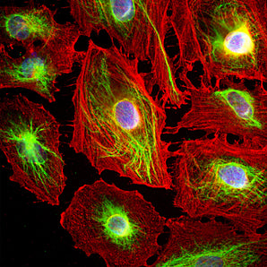 Immunofluorescence analysis of HeLa cells costained with rabbit pAb to vimentin, RPCA-Vim, dilution 1:5,000, in green, and mouse mAb to Actin, <a href="http://encorbio.com/products/mca-MCA-5J11">MCA-5J11</a>, dilution 1:500, in red. Blue is DAPI staining of nuclear DNA. The vimentin antibody stains the 10nm or intermediate filament network of the cytoskeleton. The antibody to actin labels the submembranous actin-rich cytoskeleton, stress fibers, and bundles of actin associated with cell adhesion